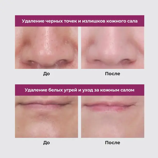 NEOGEN Pore Tight Peelşng Mousse 5 NEOGEN Pore Tight Peelşng Mousse